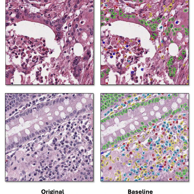 Color Space-based Hover-Net for Nuclei Instance Segmentation and Classification