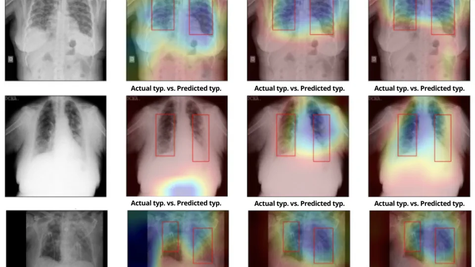 Self-supervision and Multi-task Learning: Challenges in Fine-grained COVID-19 Multi-class Classification from Chest X-rays