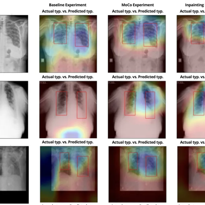 Self-supervision and Multi-task Learning: Challenges in Fine-grained COVID-19 Multi-class Classification from Chest X-rays